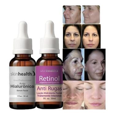 Imagem de Kit facial potente Retinol + Ácido Hialurônico 30ml - Skinhealth