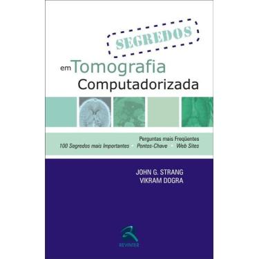 Imagem de Livro - Segredos em Tomografia Computadorizada