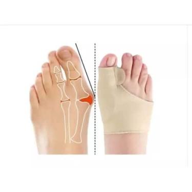 Imagem de Meias corretivas para joanete com separador de silicone - bazar do saa