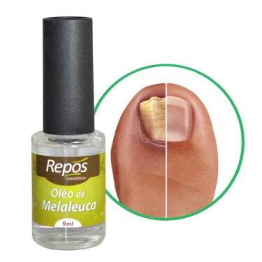 Imagem de Esmalte para Micose e Anti Fungos Óleo de Melaleuca Antifungico Base 9