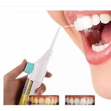 Imagem de Jato De Agua Limpeza Oral Dental Bucal Irrigador - WL.PRODUTOSS