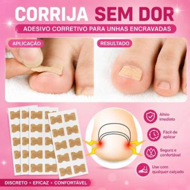 Imagem de Adesivo Corretor De Unha Encravada Órtese 40 Unidades - Difinity