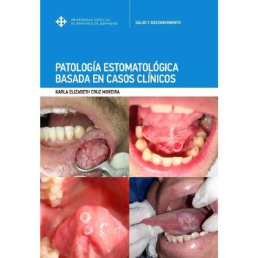 Imagem de Patología Estomatológica basada en casos clínicos-Espanhol