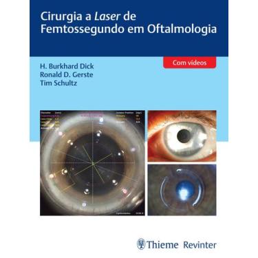 Imagem de Livro - Cirurgia a Laser de Femtossegundo em Oftalmologia