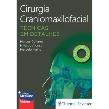 Imagem de Cirurgia Craniomaxilofacial Tecnicas Em Detalhes