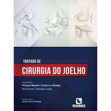 Imagem de Tratado De Cirurgia Do Joelho