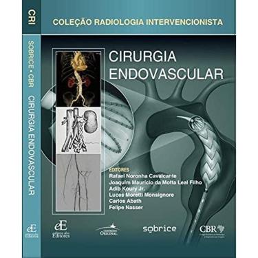 Imagem de Cirurgia Endovascular
