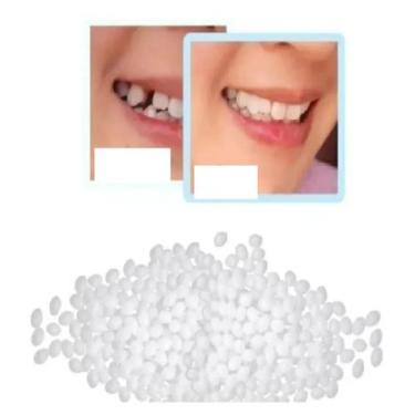 Imagem de Massa Restauração Dente Provisório 600 Bolinhas Massa - MIEMAY KIDS, B