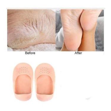 Imagem de Silicone Palmilha Meias Hidratantes Saltos Protetor - oem, Cor de pele