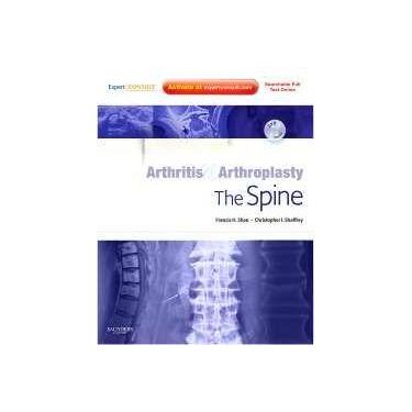 Imagem de Arthritis And Arthroplasty: The Spine - Elsevier (Importados)
