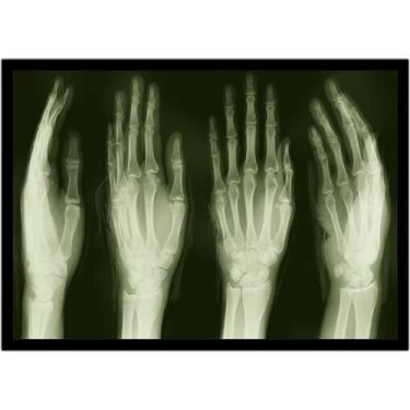 Imagem de Quadro Decorativo Medicina Radiografia Raio X Consultórios Com Moldura