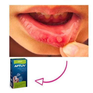 Imagem de AFTLIV   tratamento de aftas  bucais 25ml rosa rubra - Natulab