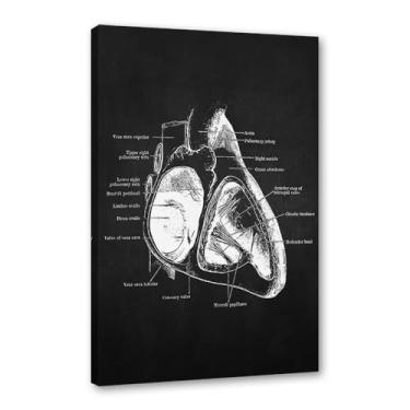 Imagem de Fundo preto anatomia humana arte médica impressões em tela imagens esqueleto músculo pôster vintage educação pintura arte decoração de parede (SKU13,30.5x45.7 cm = (30x45 cm), emoldurado (tela