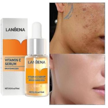 Imagem de Sérum facial, vitamina C, clareador de manchas, 15 ml, cuidados com a 