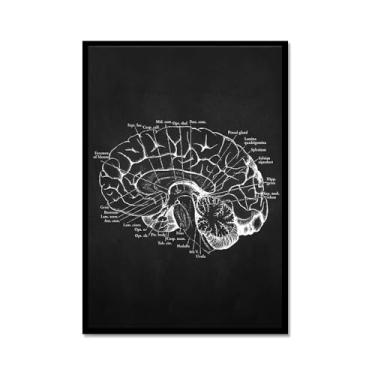 Imagem de Fundo preto anatomia humana arte médica impressões em tela imagens esqueleto músculo pôster vintage educação pintura arte decoração de parede (SKU9,30.5x40.6 cm = (30x40cm), moldura de metal preto)