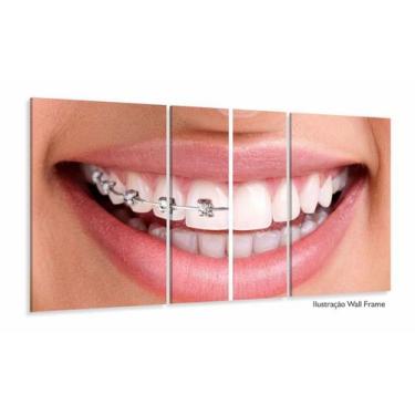 Imagem de Quadro Decorativo Dentista Aparelho 63x130mt com 3 peças - Wall Frame