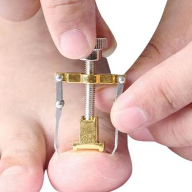 Imagem de Aparelho desencravador de unhas ferramenta pedicure manicure - SWG