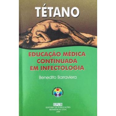 Imagem de Tetano Educaçao Medica Continuada Em Infectologia - Epub