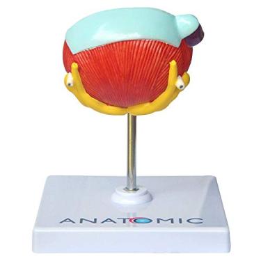 Imagem de Bexiga Urinária e Próstata com Patologias Modelo Anatômico