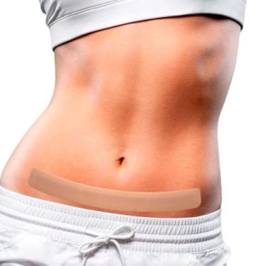 Imagem de Fita Silicone Cirurgias abdômen inferior - NullScar Abdômen M