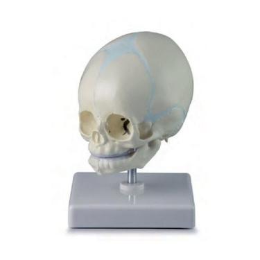 Imagem de Crânio Fetal Humano na 32ª Semana de Gestação - COLEMAN