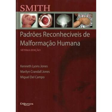 Imagem de Smith padroes reconheciveis de malformacao humana - Di Livros Editora 