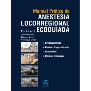 Imagem de Livro - Manual Prático de Anestesia Locorregional Ecoguiada