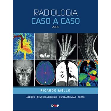 Imagem de Radiologia Caso a Caso 2020