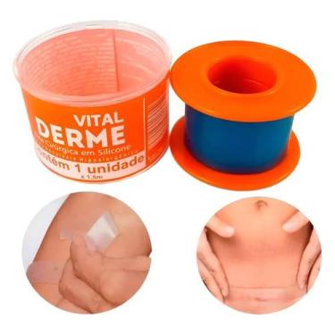 Imagem de Curativo / Fita Silicone 5Cmx5M - Vitalderme - Joãomed