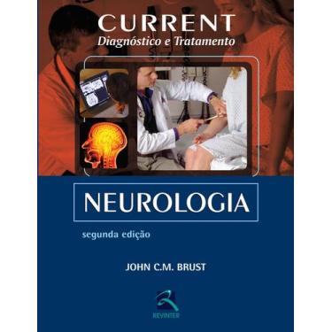 Imagem de Livro - Current Neurologia
