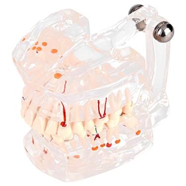 Imagem de Modelo de Educação Dentária Modelo de Dente Doença Dentadura Modelo de Dente Transparente Modelo de Cárie Dentária Gengival Com Nervo para Estudo de Ensino Odontológico