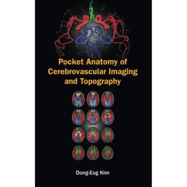 Imagem de Pocket Anatomy Of Cerebrovascular Imaging And Topography