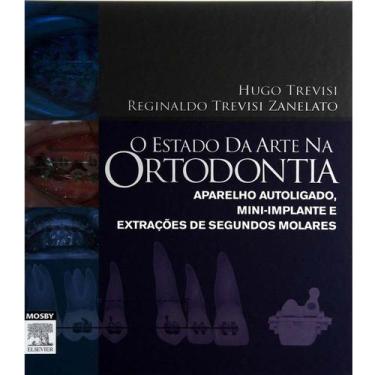 Imagem de Livro - Estado Da Arte Na Ortodontia, O - Trevisi *** - Elsevier