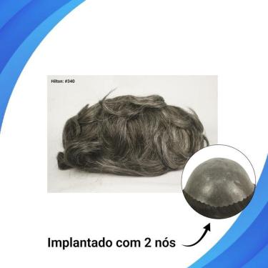 Imagem de Protese Capilar Micropele Hilton Tamanho 20X25 D=130%