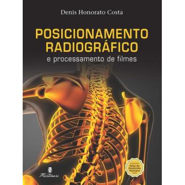 Imagem de Livro Posicionamento Radiográfico E Processamento De Filmes - Completo