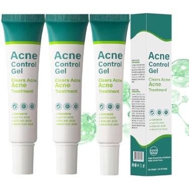 Imagem de Sérum de ácido azelaico para tratamento de acne facial, tratamento de limpeza de acne corporal com 10% de ácido azelaico e ácido salicílico, creme essencial facial para cuidados com a pele sensível