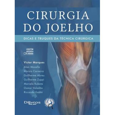 Imagem de Cirurgia Do Joelho Dicas E Truques Da Técnica Cirúrgica