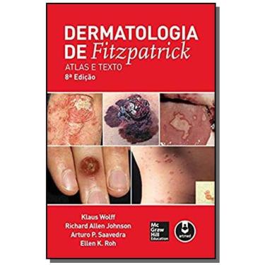 Imagem de Dermatologia De Fitzpatrick: Atlas E Texto 8Ed.