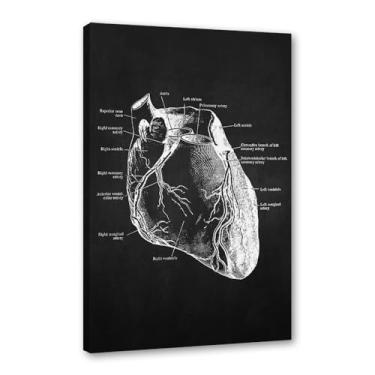 Imagem de Fundo preto anatomia humana arte médica impressões em tela imagens esqueleto músculo pôster vintage educação pintura arte decoração de parede (SKU12,30.5x40.6 cm = (30x40cm), emoldurado (tela embalada