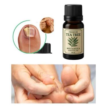 Imagem de Óleo Essêncial de Melaleuca Tea Tree 20ml - dermami