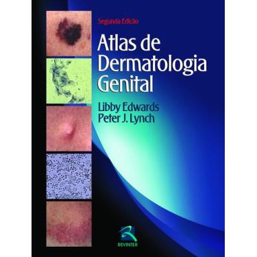 Imagem de Livro - Atlas De Dermatologia Genital