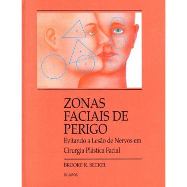 Imagem de Zonas Faciais de Perigo: Evitando a Lesão de Nervos em Cirurgia Plástica Facil