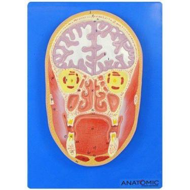 Imagem de Cabeça Humana em Corte Frontal e Cérebro - ANATOMIC