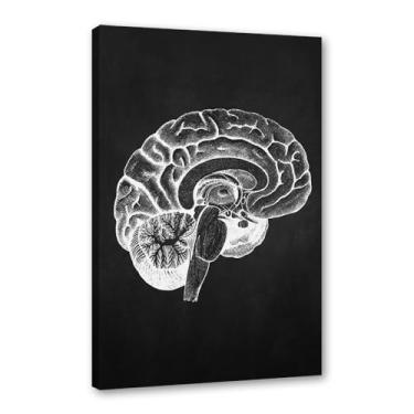 Imagem de Fundo preto anatomia humana arte médica impressões em tela imagens esqueleto músculo pôster vintage educação pintura arte decoração de parede (SKU10,30.5x40.6 cm = (30x40cm), emoldurado (tela embalada