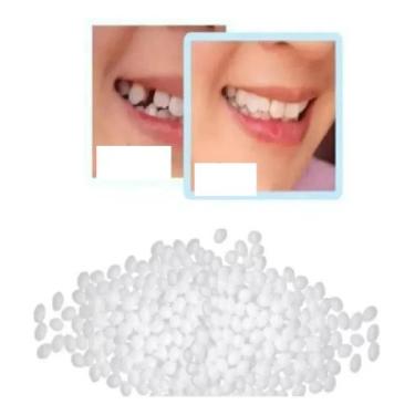 Imagem de Massa Restauração Dente Provisório 230 Bolinhas Massa - Congratulation