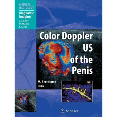 Imagem de Color Doppler us of the Penis