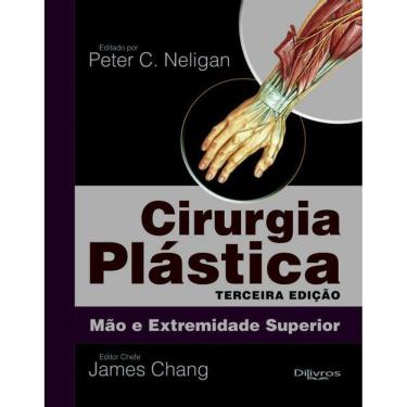 Imagem de Cirurgia Plastica  Mao E Extremidade Superior