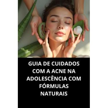 Imagem de Livro Guia De Cuidados Com A Acne Na Adolescência Com Fórmulas Naturai