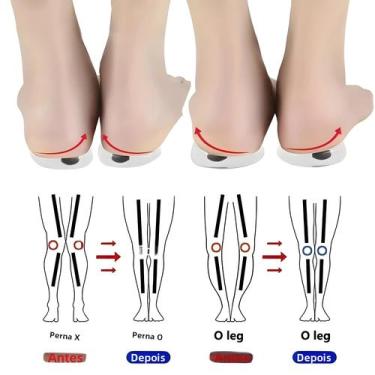 Imagem de Palmilhas Ortopédicas Unissex De Gel De Silicone Para Correção De Pern