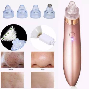 Imagem de Removedor De Cravos E Espinhas Limpeza Facial Cor Rosa